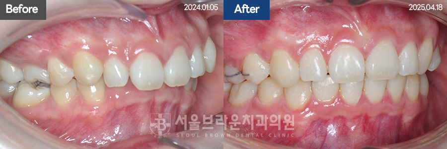 b05cd4bba924b3cd77aa7a17d37d707b_1768206