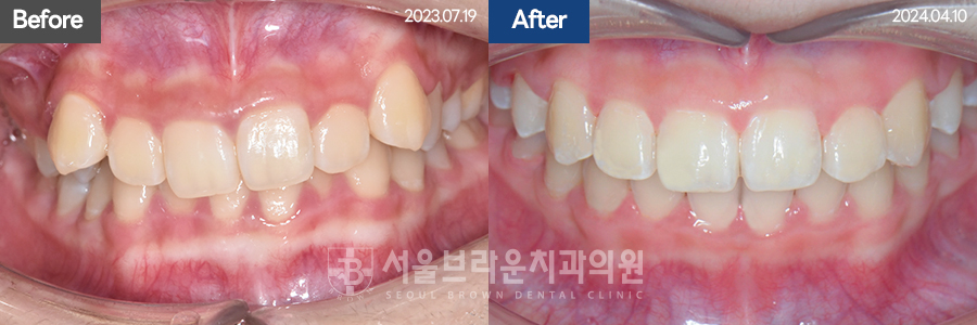 b05cd4bba924b3cd77aa7a17d37d707b_1768206