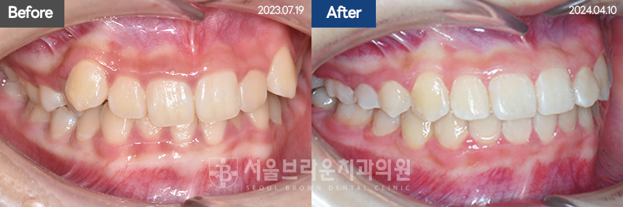 b05cd4bba924b3cd77aa7a17d37d707b_1768206