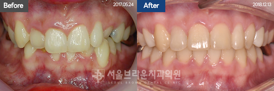 b05cd4bba924b3cd77aa7a17d37d707b_1768207