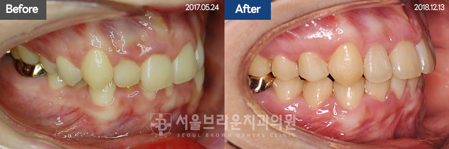 b05cd4bba924b3cd77aa7a17d37d707b_1768207