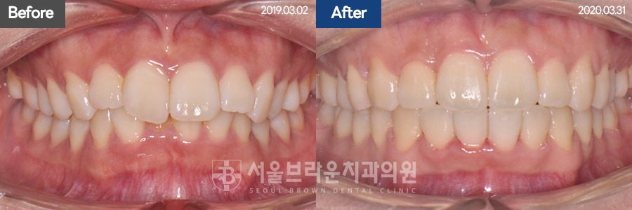 b05cd4bba924b3cd77aa7a17d37d707b_1768207