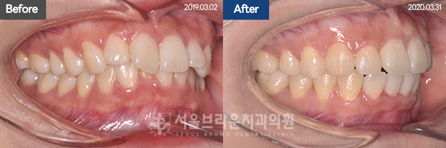 b05cd4bba924b3cd77aa7a17d37d707b_1768207