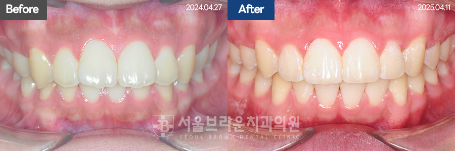 b05cd4bba924b3cd77aa7a17d37d707b_1768207