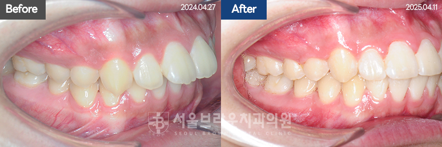 b05cd4bba924b3cd77aa7a17d37d707b_1768207