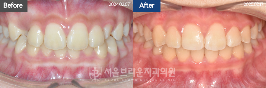 b05cd4bba924b3cd77aa7a17d37d707b_1768207