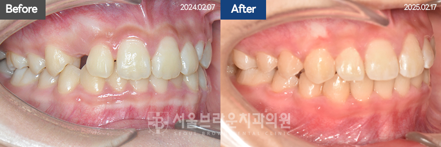 b05cd4bba924b3cd77aa7a17d37d707b_1768207