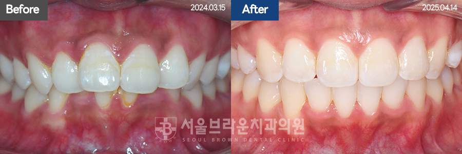 b05cd4bba924b3cd77aa7a17d37d707b_1768207