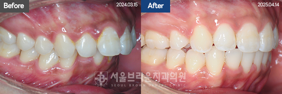 b05cd4bba924b3cd77aa7a17d37d707b_1768207