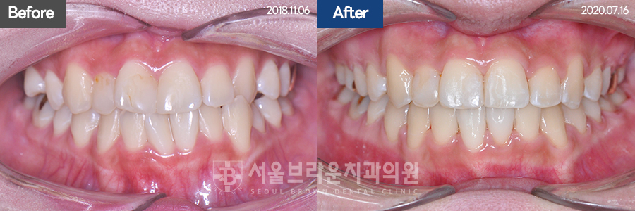 f62393272295911783ba8065c4d108bd_1769747