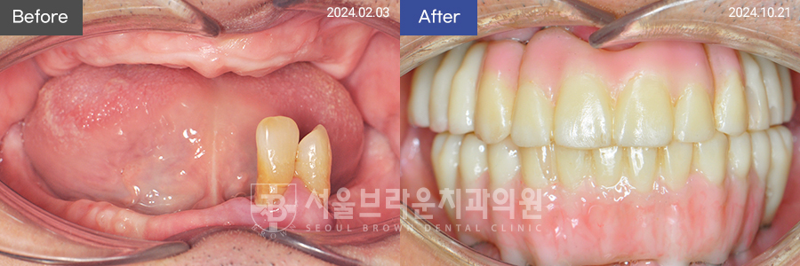 fc5e68bddb697774d19a9e1cee5f29be_1768524