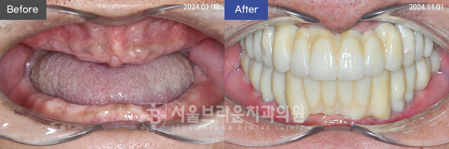 fc5e68bddb697774d19a9e1cee5f29be_1768525