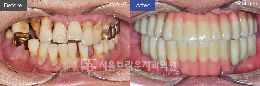 fc5e68bddb697774d19a9e1cee5f29be_1768525