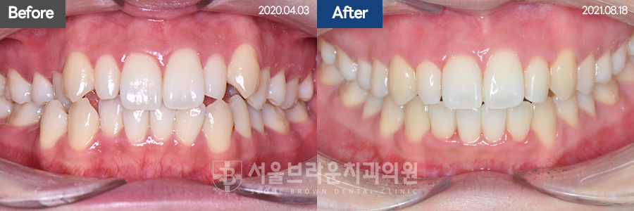 0a710ba52160b88b98a11ec38c52b9f7_1770343