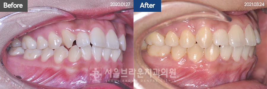 35c5ec049c94abe8c0cc076b0577bbb9_1770109