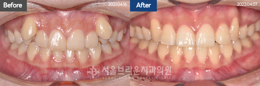 35c5ec049c94abe8c0cc076b0577bbb9_1770109