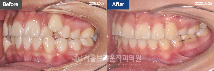 722438101be41d955da718976dd5f896_1771987