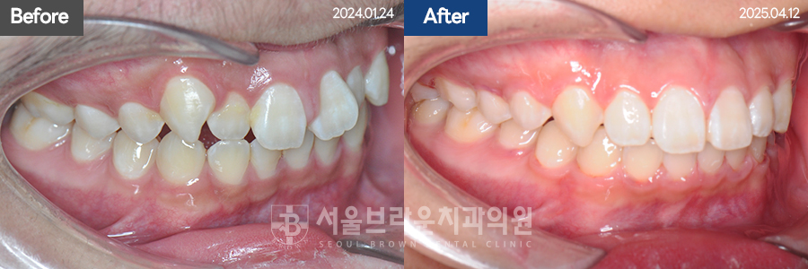 8385d9c233781b51decf0f76a154bd80_1770178