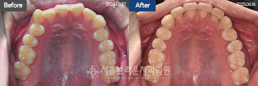 8e27322d97b9b0034b5b80cf55a1afe3_1770715