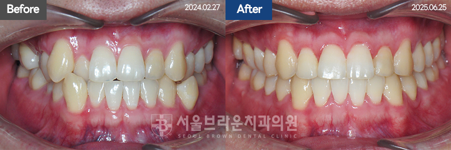 8e27322d97b9b0034b5b80cf55a1afe3_1770715