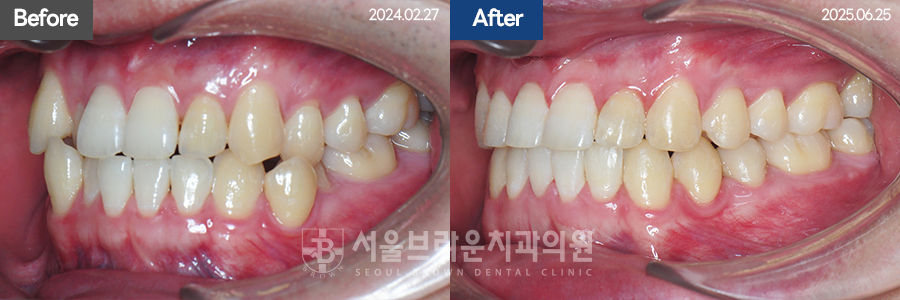 8e27322d97b9b0034b5b80cf55a1afe3_1770715