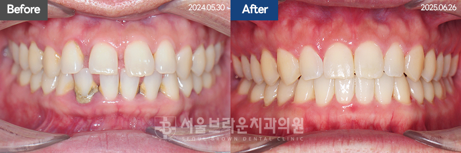 8e27322d97b9b0034b5b80cf55a1afe3_1770715