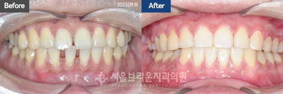 8e27322d97b9b0034b5b80cf55a1afe3_1770715