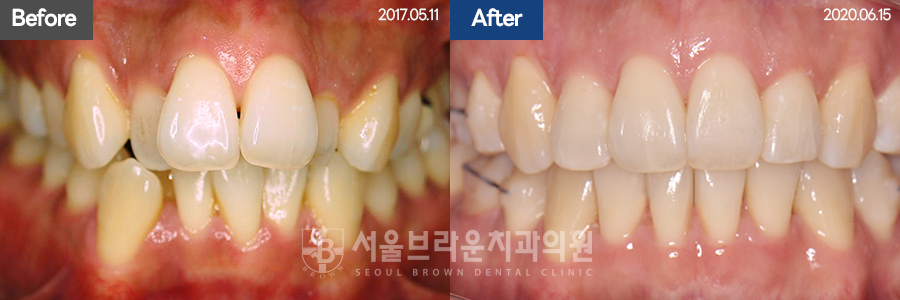 d0e5e5b4e41cb9e084cc3d184f0b892d_1771912