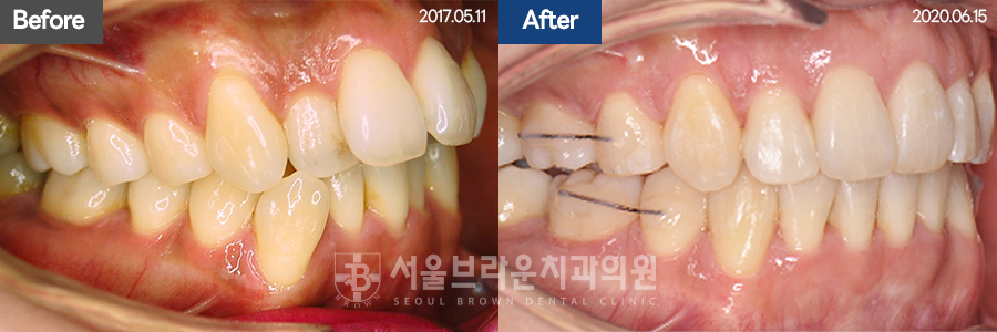 d0e5e5b4e41cb9e084cc3d184f0b892d_1771912