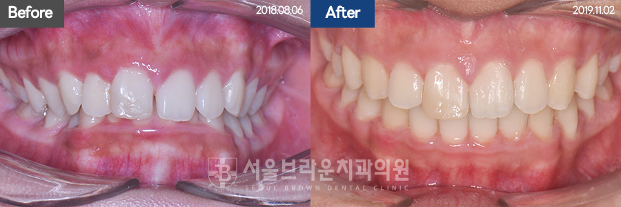 d0e5e5b4e41cb9e084cc3d184f0b892d_1771915