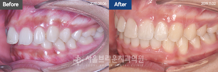 d0e5e5b4e41cb9e084cc3d184f0b892d_1771915