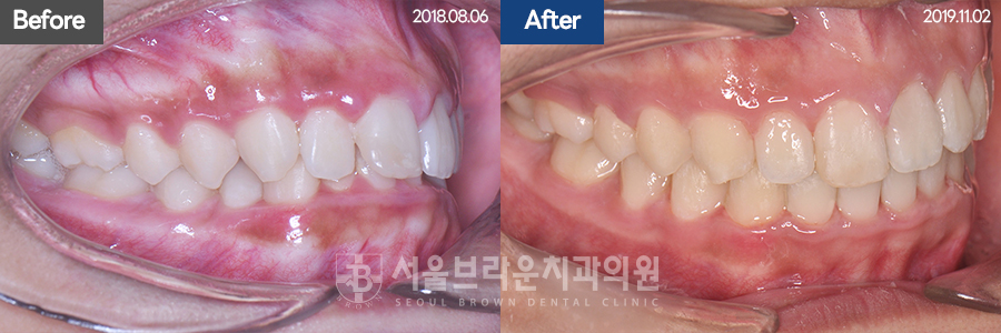 d0e5e5b4e41cb9e084cc3d184f0b892d_1771915