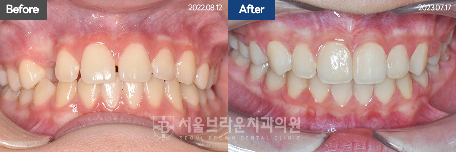 d62aeae0c3066f92214b0281fcb3ba74_1771832