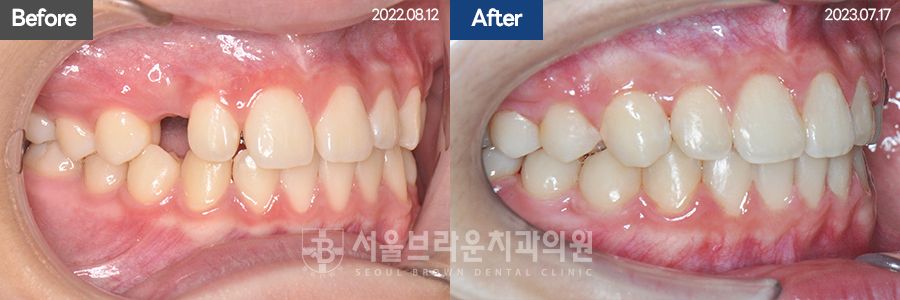 d62aeae0c3066f92214b0281fcb3ba74_1771832