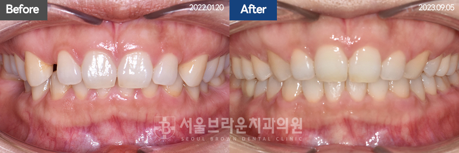 d62aeae0c3066f92214b0281fcb3ba74_1771832