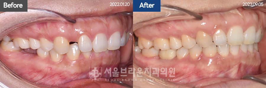 d62aeae0c3066f92214b0281fcb3ba74_1771832