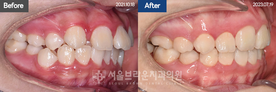 d62aeae0c3066f92214b0281fcb3ba74_1771833