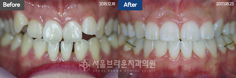 5da2cb96fee92f70613afa6f99c5555c_1773128