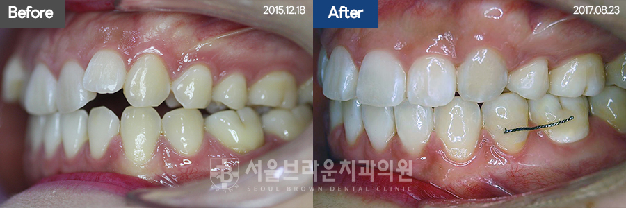 5da2cb96fee92f70613afa6f99c5555c_1773128