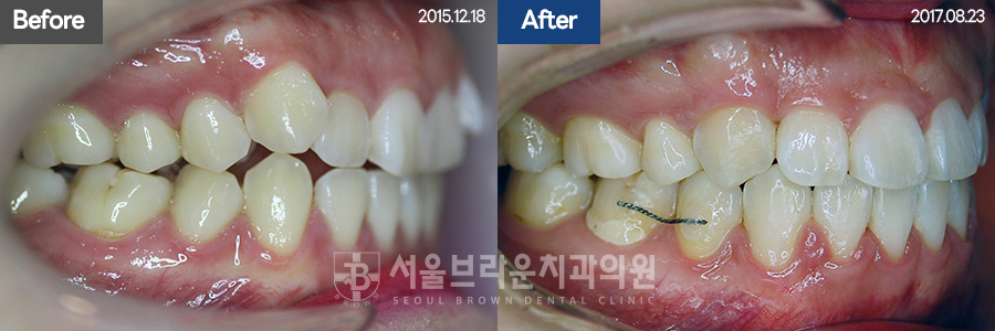 5da2cb96fee92f70613afa6f99c5555c_1773128