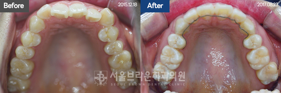 5da2cb96fee92f70613afa6f99c5555c_1773128