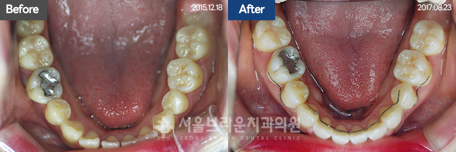 5da2cb96fee92f70613afa6f99c5555c_1773128