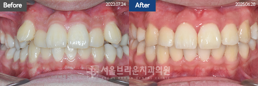 5da2cb96fee92f70613afa6f99c5555c_1773128