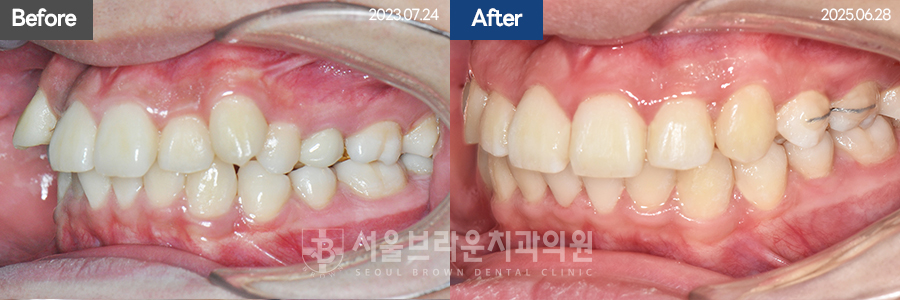 5da2cb96fee92f70613afa6f99c5555c_1773128