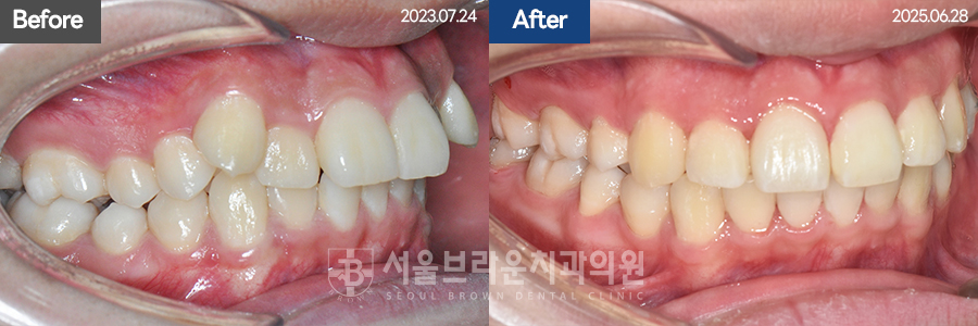 5da2cb96fee92f70613afa6f99c5555c_1773128