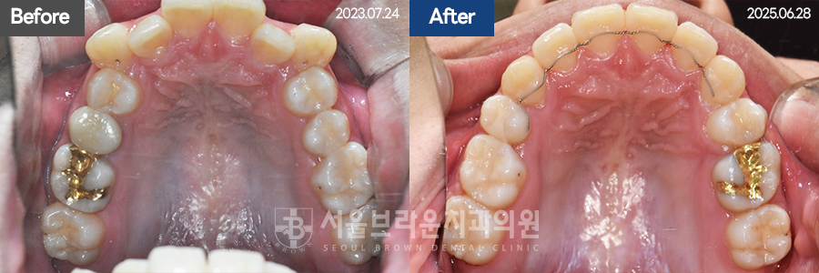 5da2cb96fee92f70613afa6f99c5555c_1773128