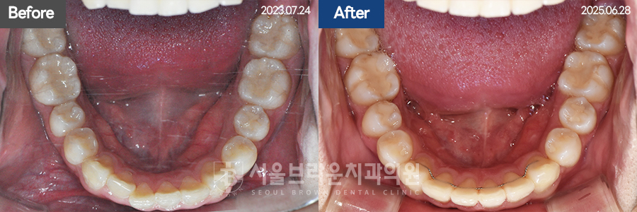 5da2cb96fee92f70613afa6f99c5555c_1773128