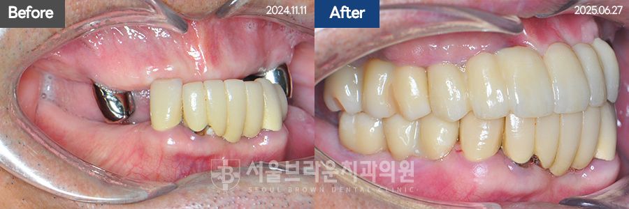 5da2cb96fee92f70613afa6f99c5555c_1773129