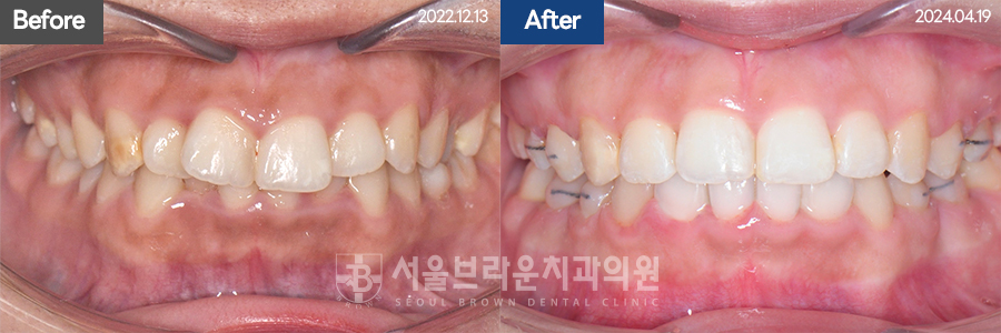 81b565db4ffd9381f7370eddec262246_1777525