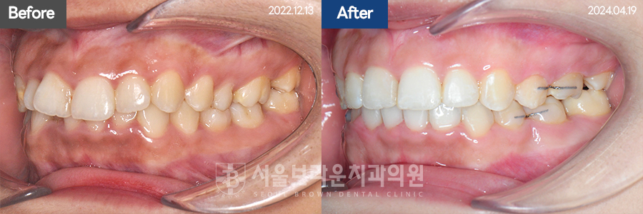 81b565db4ffd9381f7370eddec262246_1777525